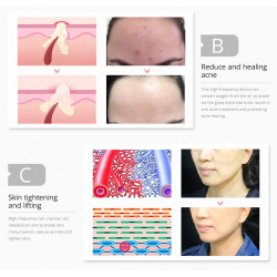 High Frequency Facial Machine Skin Acne Spot Wrinkles Remover Beauty Device With 4 Electrodes Red Color Elitzia ETSR001