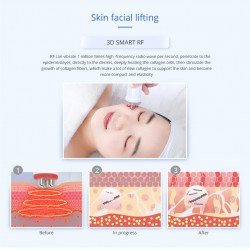 RF Facial Wrinkle Removal Face Lifting Cellulite Reduction Skin Care Device Weight loss Beauty Machine Home Use Elitzia ET22Y2