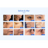 RF Facial Wrinkle Removal Face Lifting Cellulite Reduction Skin Care Device Weight loss Beauty Machine Home Use Elitzia ET22Y2