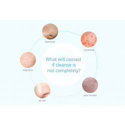 3 In 1 Diamond Dermabrasion Portable Face Peeling Acne Blackhead Removal Sprayer Skin Care Beauty Machine Elitzia ET22P3