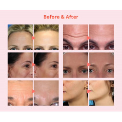 Diamond Microdermabrasion Bio Mico Photon Machine Multifunction Facial Care Device Elitzia ET1806H