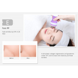 3 In 1 Massager Body Shaping Massager Machine For Skin Tightening Winkle Removal Equipment Home Beauty Devices Elitzia MS32J3