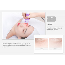 3 In 1 Massager Body Shaping Massager Machine For Skin Tightening Winkle Removal Equipment Home Beauty Devices Elitzia MS32J3