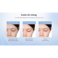 Diamond Dermabrasion Microdermabrasion Acne Blackhead Remover Eyes Care Relieves Dark Circles Facial Care Device Elitzia ET31P4