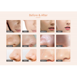 4 In 1 Diamond Dermabrasion Skin Scrubber Vacuum Facial peeling Sprayer Acne Remover Skin Care Beauty Machine Elitzia ET33P4