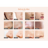4 In 1 Diamond Dermabrasion Skin Scrubber Vacuum Facial peeling Sprayer Acne Remover Skin Care Beauty Machine Elitzia ET33P4