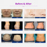 Pro Smart Beauty Device 8 in1 Skin Care Face Body ShapeToning Slimming Device Wrinkle Removing Machine Elitzia ET98D3