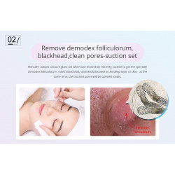 Elitzia Diamond Dermabrasion Vacuum Facial peeling Machine Blackhead Acne Remover Skin Care Beauty Machine ET22P1