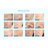 Elitzia Diamond Dermabrasion Vacuum Facial peeling Machine Blackhead Acne Remover Skin Care Beauty Machine ET22P1