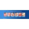 Elitzia Cooled Radio Frequency Facial Treatment Machine At Home Use ET1161