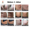 Body Shaper Fat Burning 5 in 1 Skin Lifting Cellulite Reduction Anti-Aging Wrinkle Remover Facial Care Equipment Elitzia ET2021