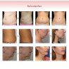 5 in1 RF Body Shaper Skin Lifting Machine Blue Elitzia ET5494