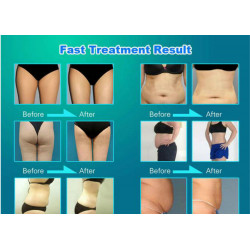 Slimming Machine Weight Loss 5 In 1 Vacuum RF Facial Beauty Machine Elitzia ETPC12