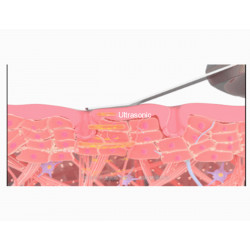 Beauty Tools Ultrasonic Skin Scrubber Blackhead Remover Pore Cleanser Home Use Elitzia ET8023