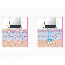 Beauty Tools Ultrasonic Skin Scrubber Blackhead Remover Pore Cleanser Home Use Elitzia ET8023