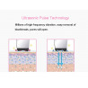 Beauty Tools Ultrasonic Skin Scrubber Blackhead Remover Pore Cleanser Home Use Elitzia ET8023