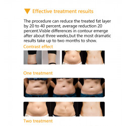 4 cryo handles body beauty slimming machine weight loss body sculpting slim lift body shaper Cool shape machine CTL18 3S