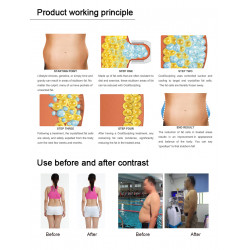 4 cryo handles body beauty slimming machine weight loss body sculpting slim lift body shaper Cool shape machine CTL18 3S