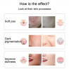 Face Beauty Skin Care Tools 7 Colors LED Phototherapy Facial Mask Skin Rejuvenation Elitzia ET029