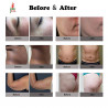 Body Slimming Machine Weight Loss Massager For Skin Tightening Cellulite Reduction Fat Remove Anti-Wrinkle Elitzia ET919