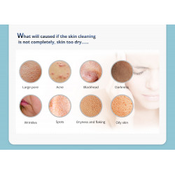 Hydro Facial 3in1  Micodermabrasion  Machine Hydrafacial Face Peeling Cleansing Device Skin  Sprayer Elitzia ET4274
