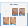 Hydro Facial 3in1  Micodermabrasion  Machine Hydrafacial Face Peeling Cleansing Device Skin  Sprayer Elitzia ET4274