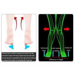 Foot Care Hallux Valgus Silicone Foot Arch Correction Insole Daily-use Elitzia ETFT020