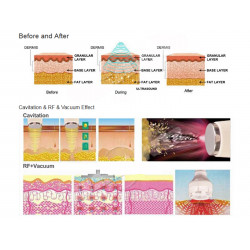 Body Shaper Skin Care Portable RF Beauty Equipment Elitzia ETE300B