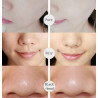 Skin Care Pore Cleanser Blackhead Remover Face Massager 4 In 1 Electric Beauty Device Elitzia ETAE8286B（Orange）
